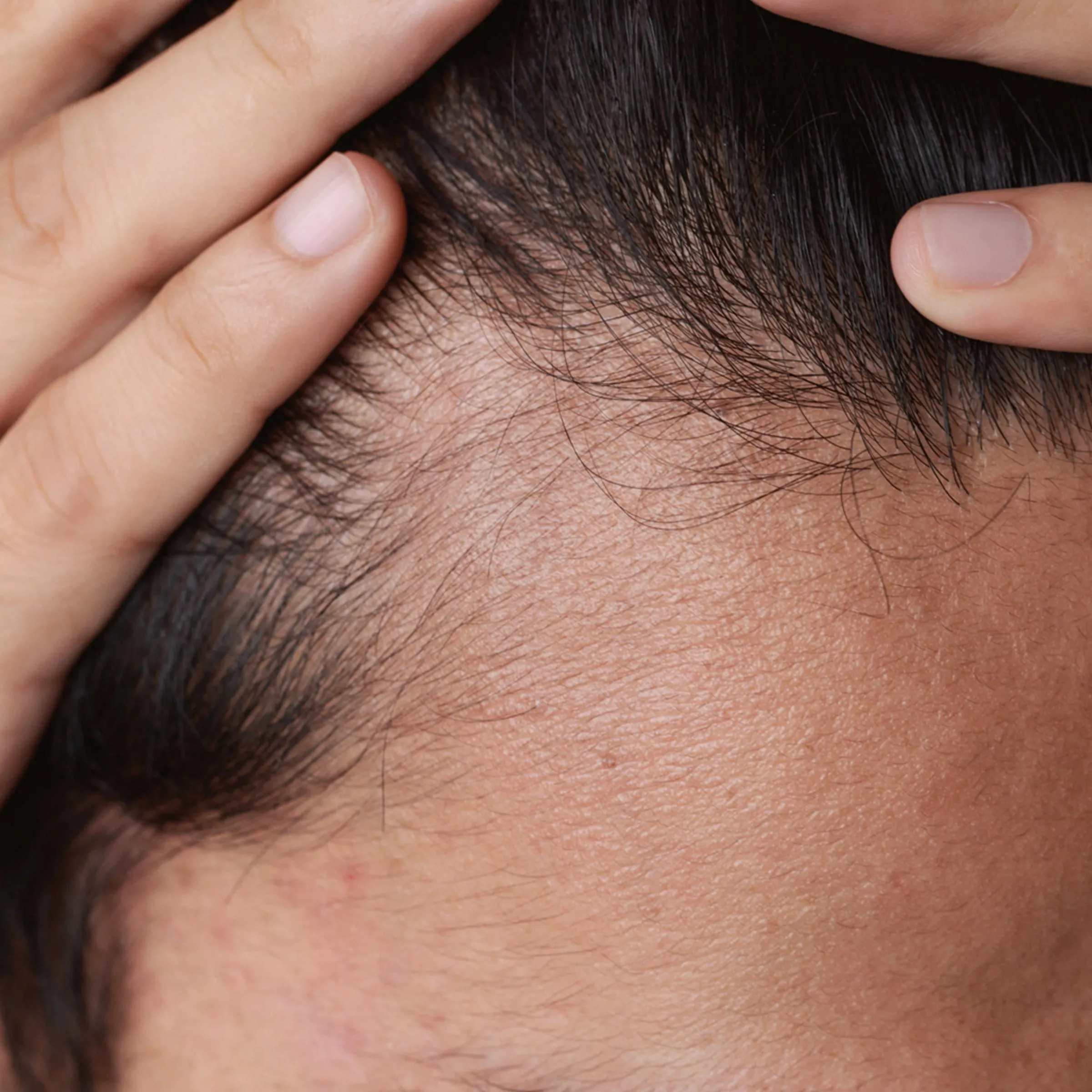 PHYTOLIUM 4 Strengthening Scalp Serum